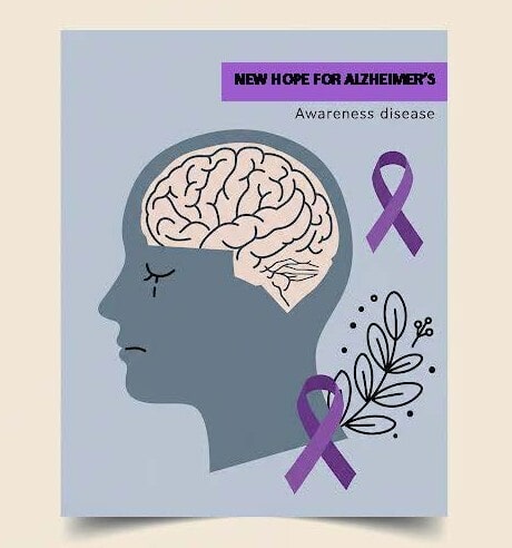 New Hope for Alzheimer's Disease Seminar